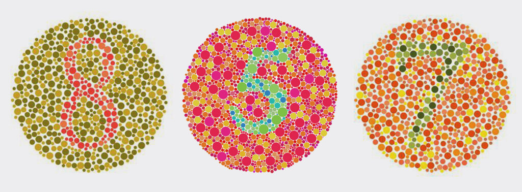 Chromatopsia - myRetina Standard Ophthalmology Center - Athens
